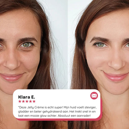 Voor en na resultaat met collageen jelly crème – egalere teint en verbeterde huidelasticiteit.