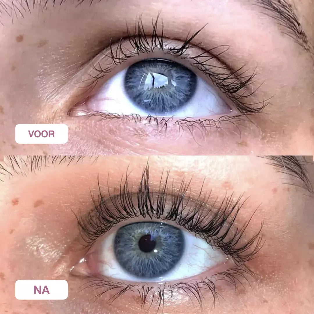 Langere wimpers binnen 4 weken met het wimpergroei serum. Zie hier het voor en na effect van ons wimper serum. 